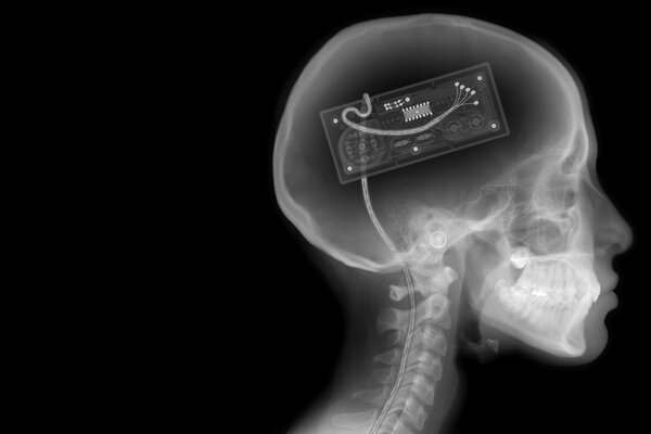 Gamepad w czaszce na zdjęciu rentgenowskim. Szkielet na czarno-białym tle