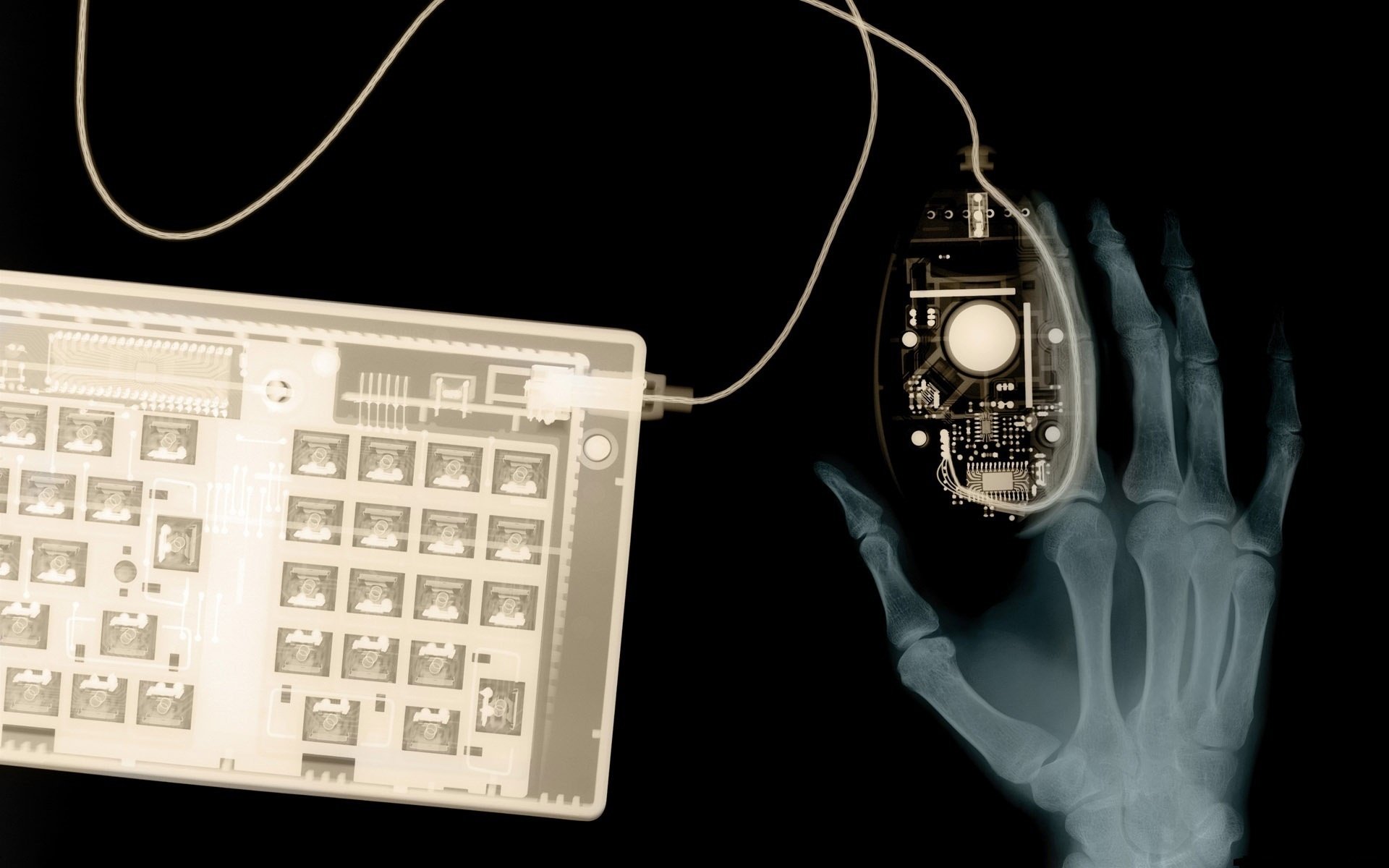 hand keyboard x-ray