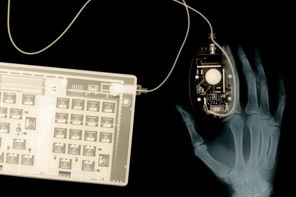 X-ray of a human hand with a mouse and keyboard