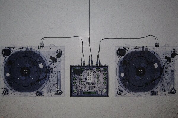 Radiographie de l installation musicale