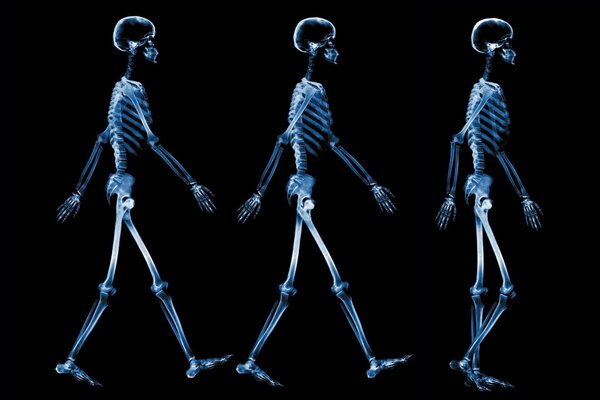 Tre scheletri nella radiografia