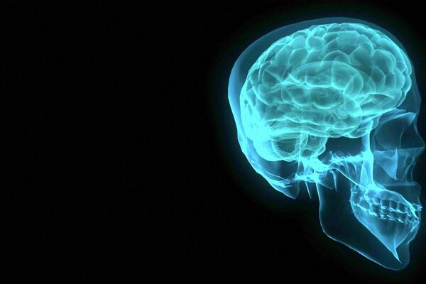 Рентген головы и мозга голубого цвета на чёрном фоне