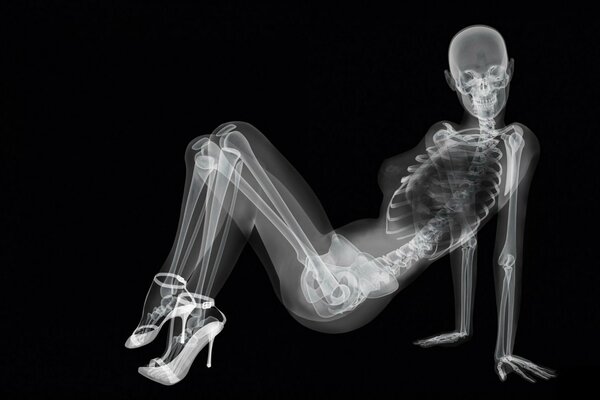 Sexy X-ray of a girl in heels