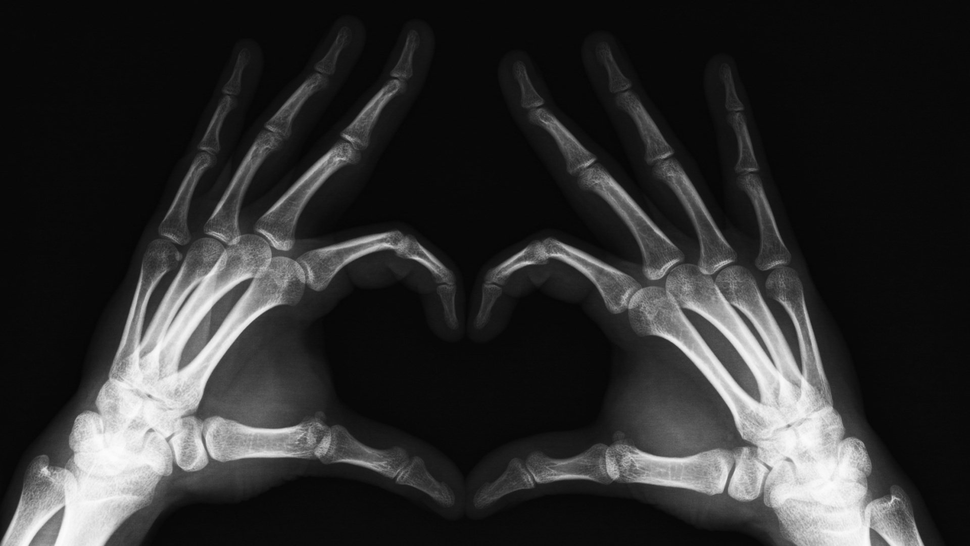 x-rays hands fingers of course