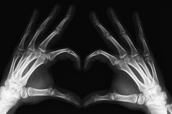 Radiografia delle mani delle dita e degli arti