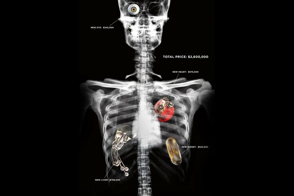 Radiographie d une compétence humaine avec Description