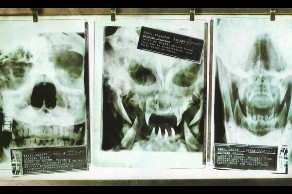 Рентгеновские снимки чужого из фильма Хищник